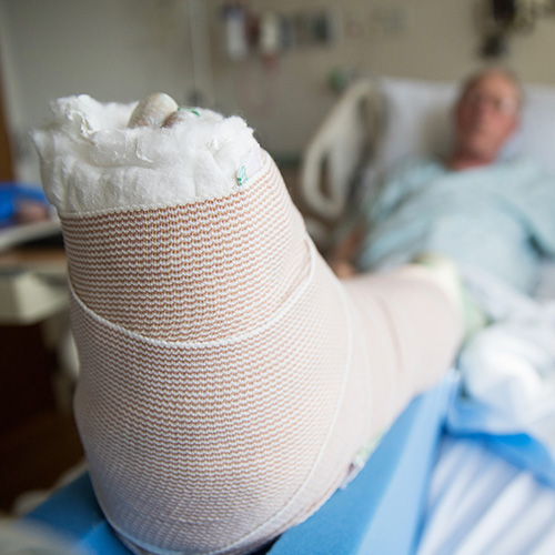 Man in hospital bed with foot in a cast